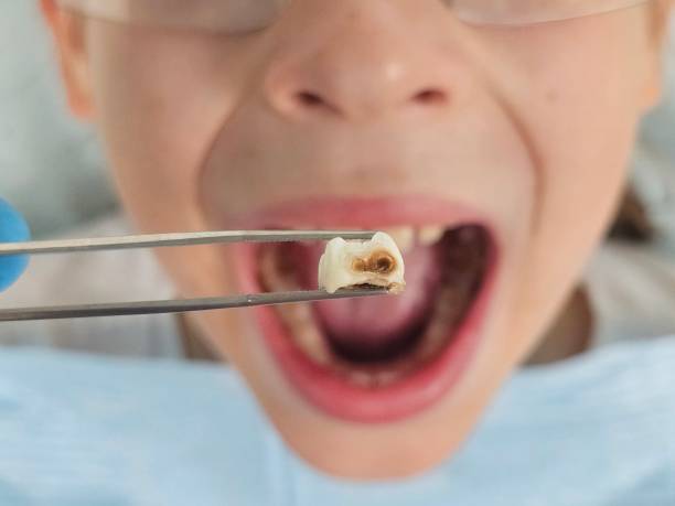 Best Emergency Wisdom Teeth Removal in Camn, DE